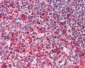 PAK4 Antibody (Internal)